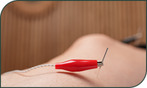 Melanie-Acupuncture_Electrostimulation Mélanie Acupuncture Electrostimulation