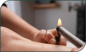 Melanie-Acupuncture_Moxa Mélanie Acupuncture Moxa